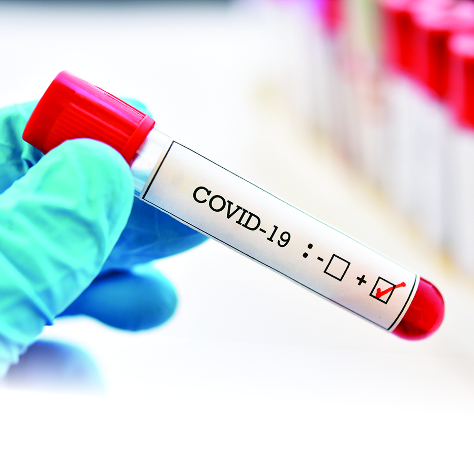 Covid 19 image Lessons for COVID-19 Impact -Temi Obasanya (nee Busari)